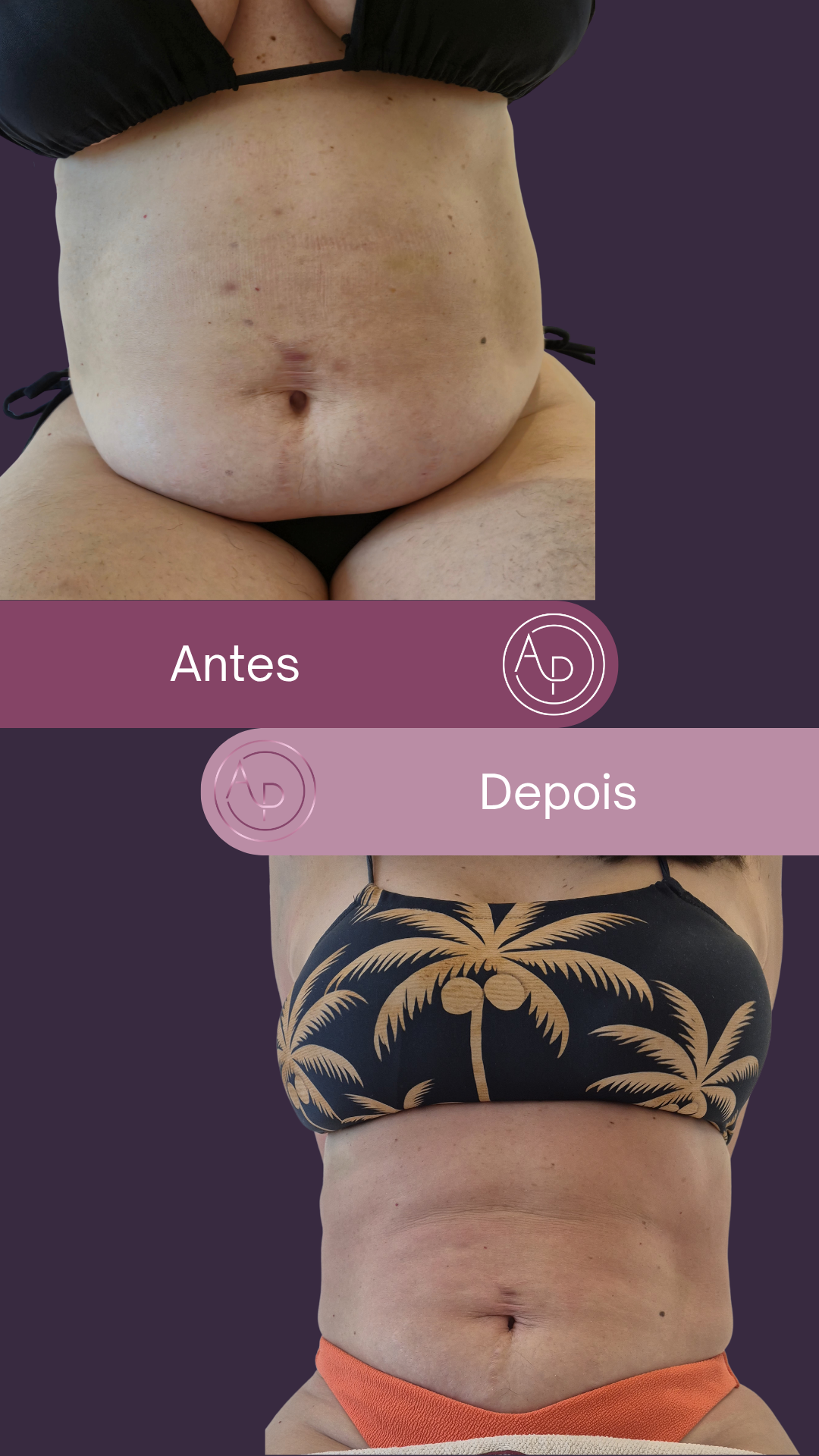 Resultado 1