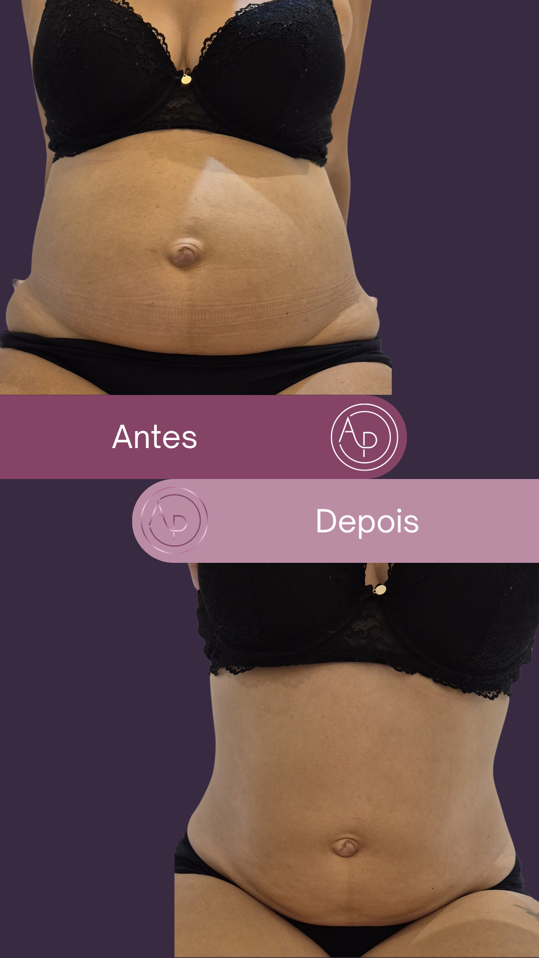 Resultado 4