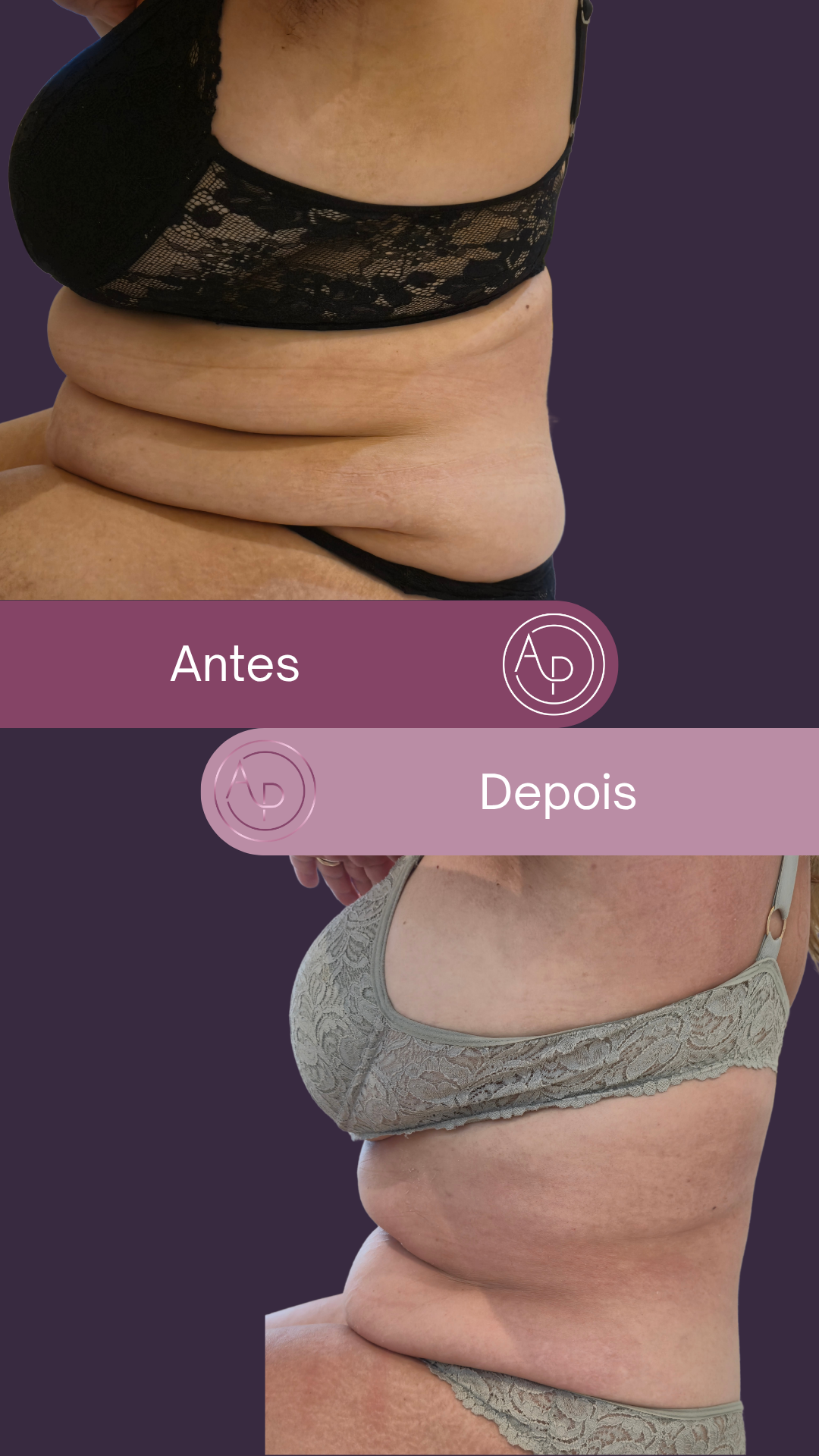 Resultado 5