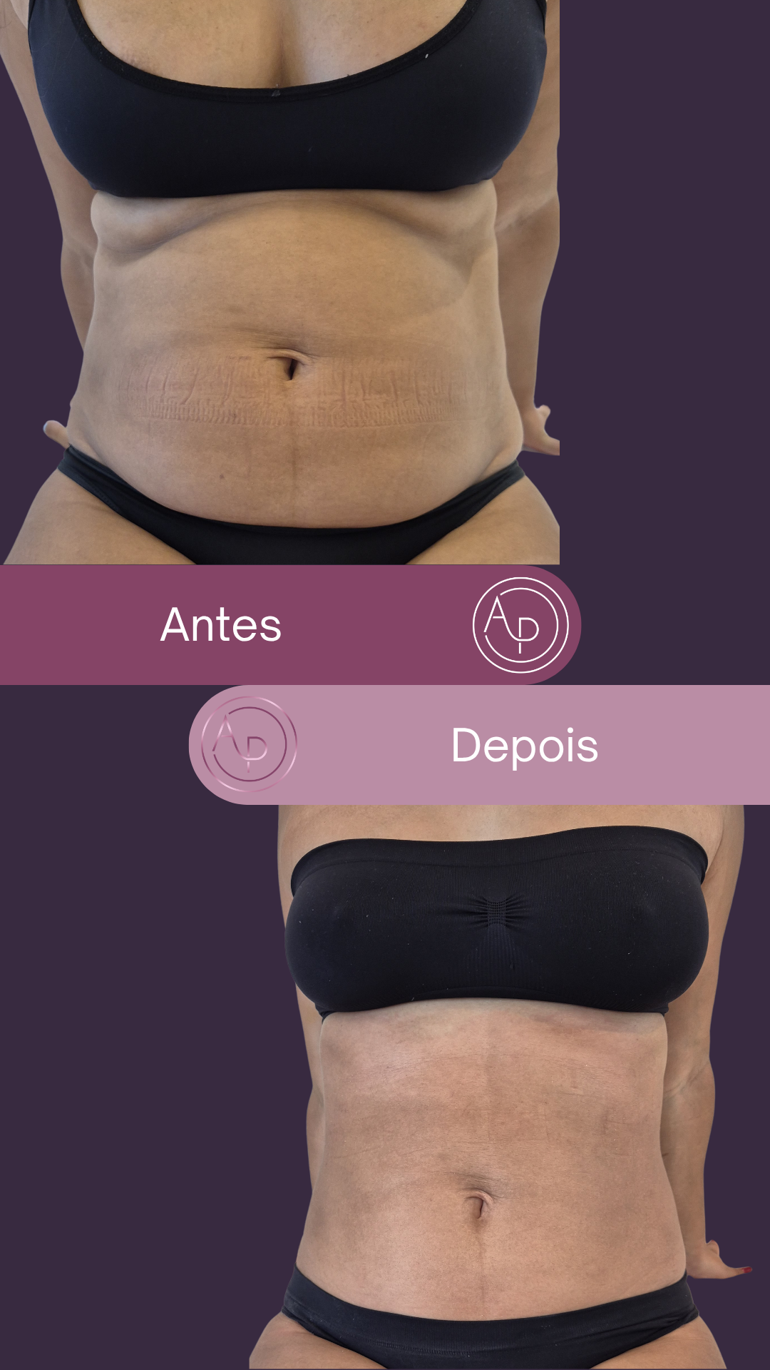 Resultado 6
