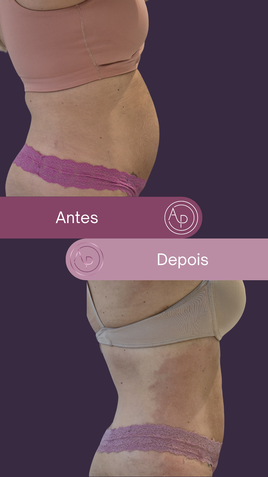 Resultado 7