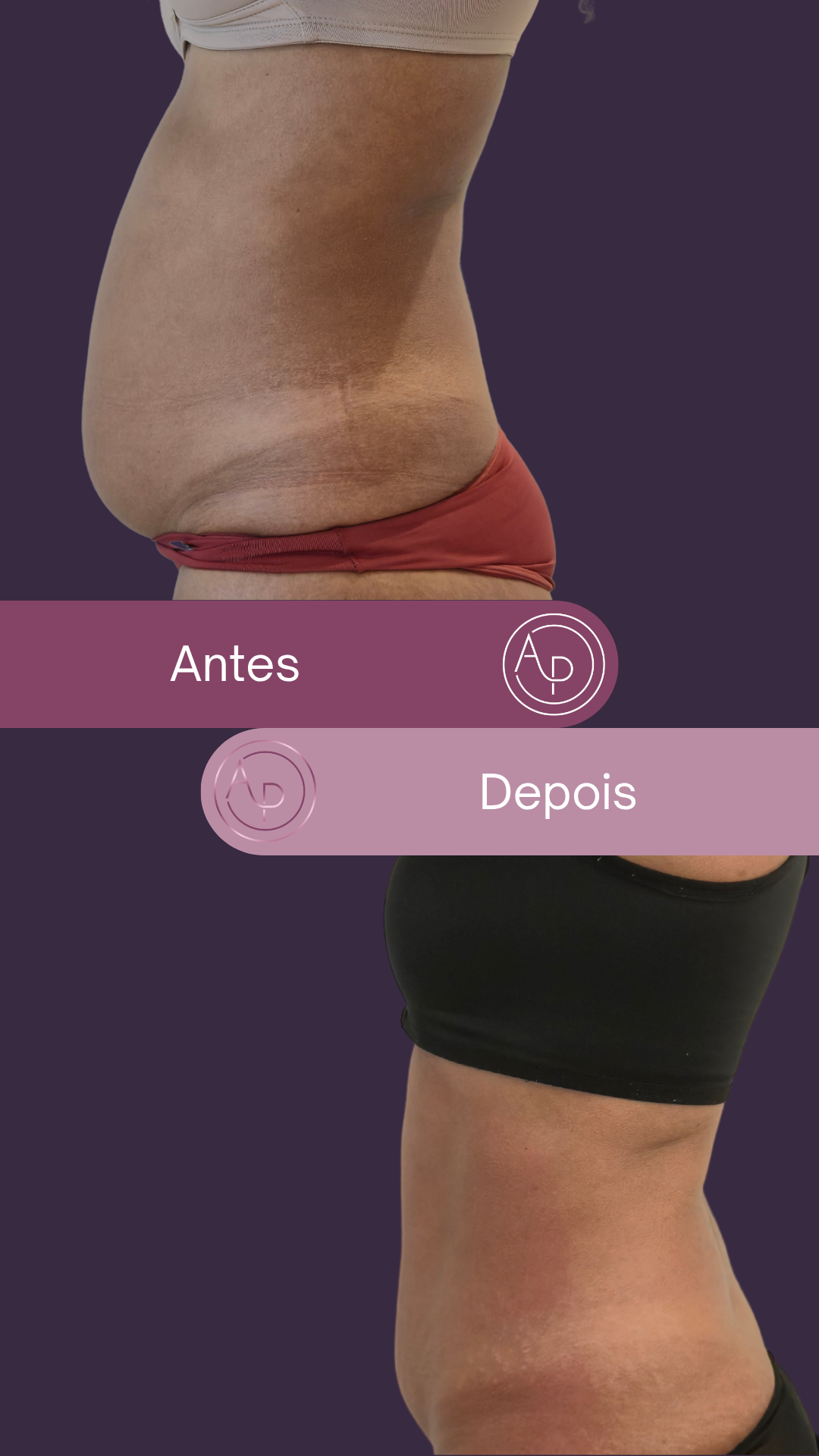 Resultado 11