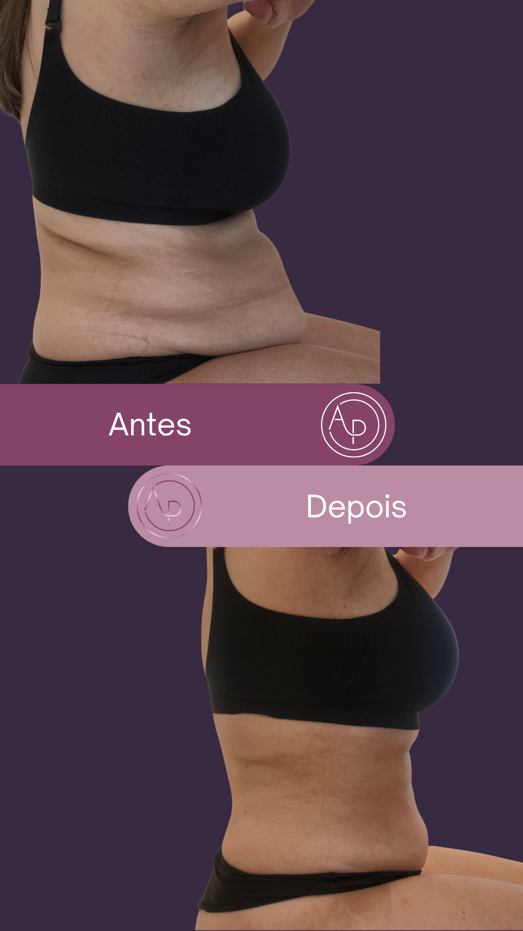 Resultado 14