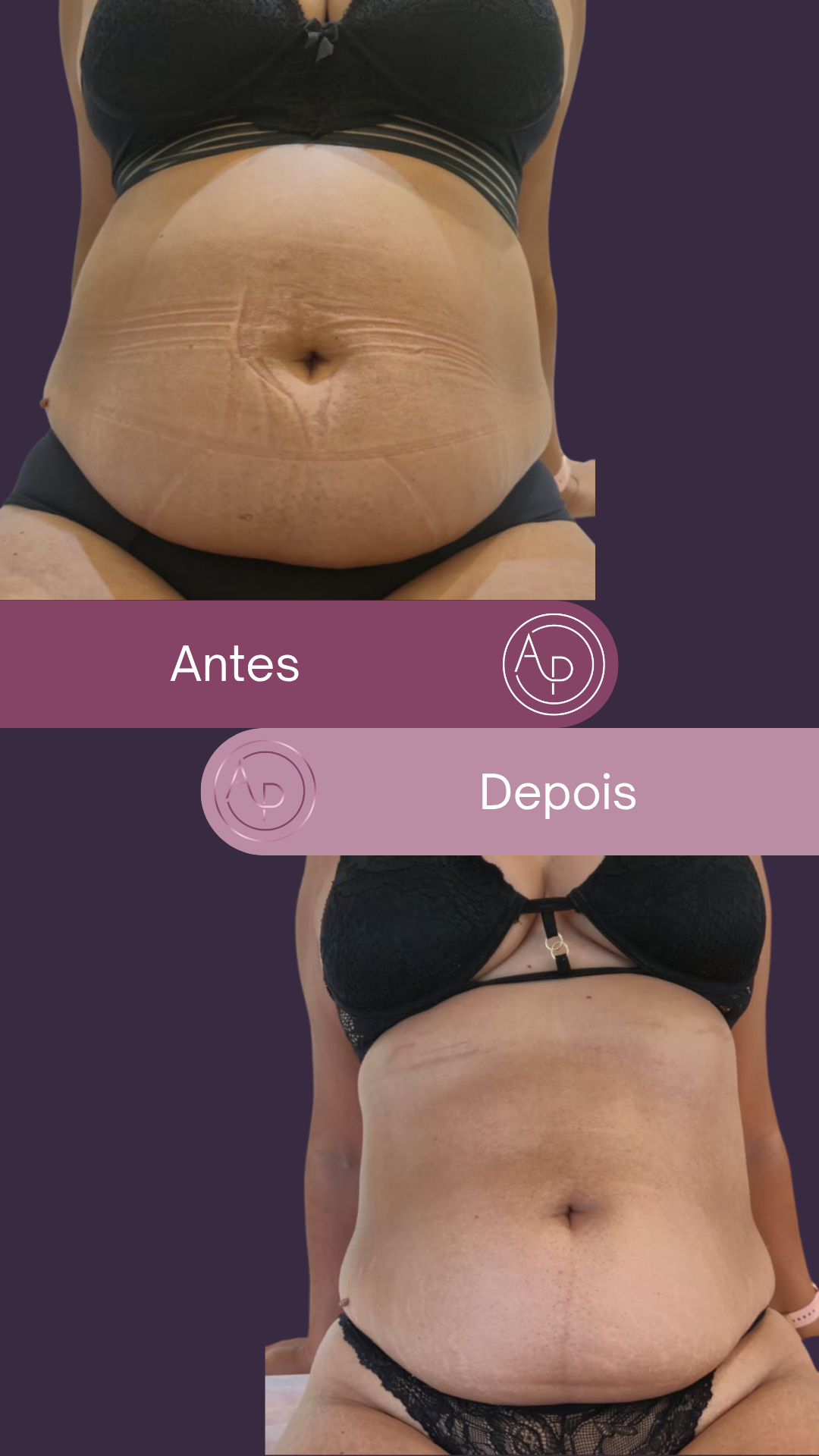 Resultado 16