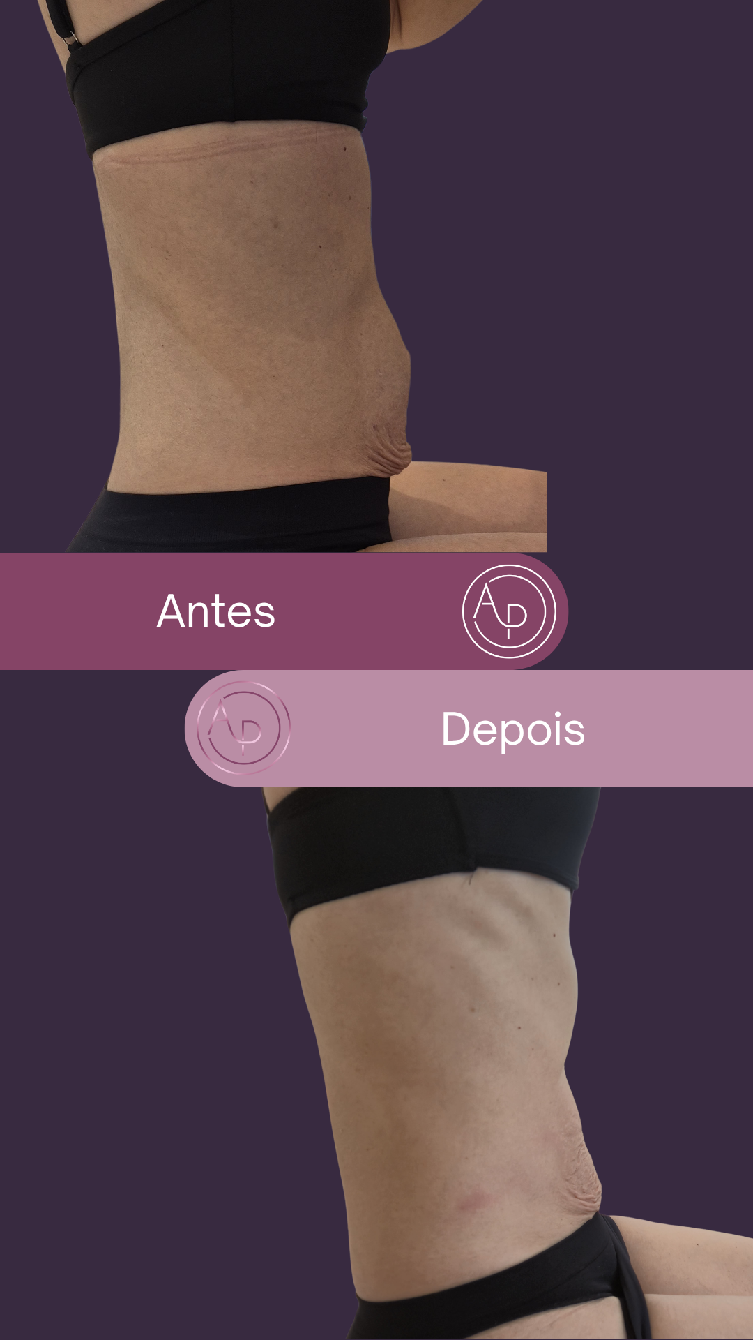 Resultado 17